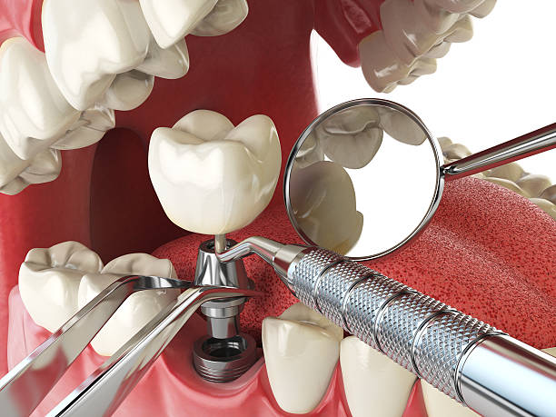 Best Emergency Dental Care for Trauma or Injury in Grant, NE